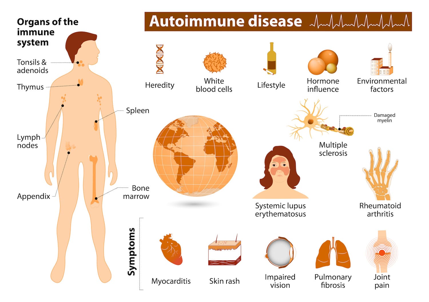 Autoimmune Disease Treatment | Reduce Flares & Balance Immunity
